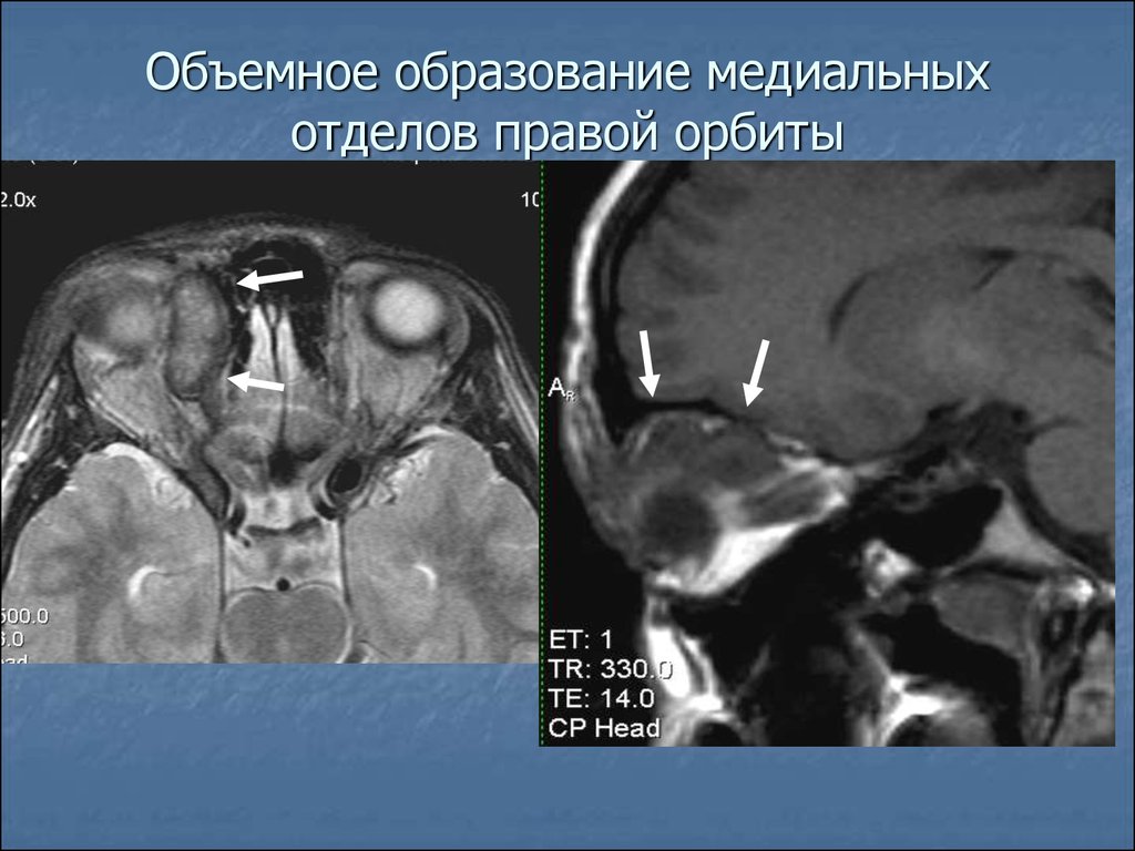 Образование мрт