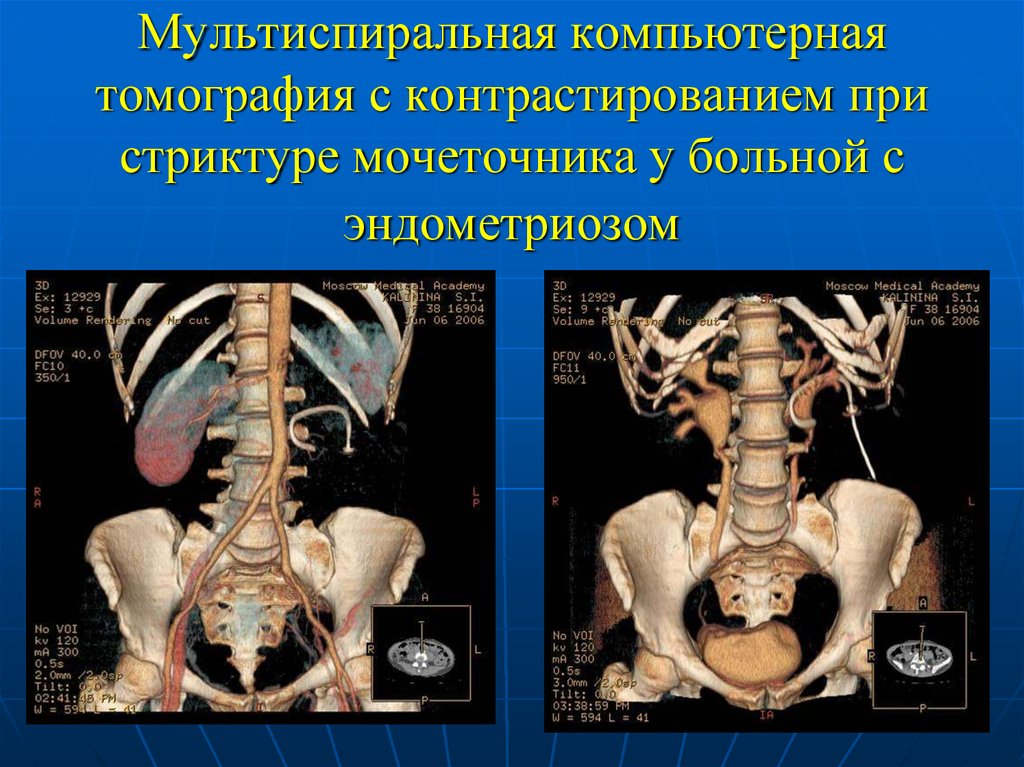 Мскт с контрастированием. Мультиспиральная кт. Мультиспиральная компьютерная томография с контрастированием. Кт Мультиспиральная кт. Многослойная компьютерная томография.