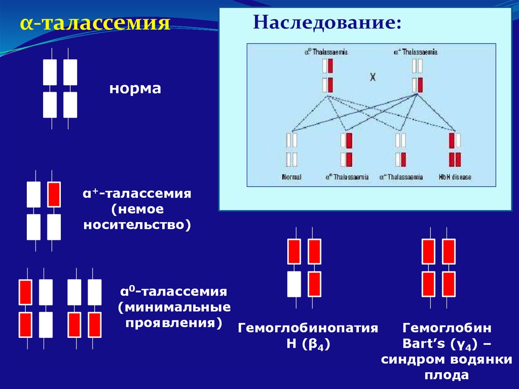 Талассемия что это. Талассемия фенотипические проявления. Альфа талассемия. Наследование талассемии. Талассемия Тип наследования.