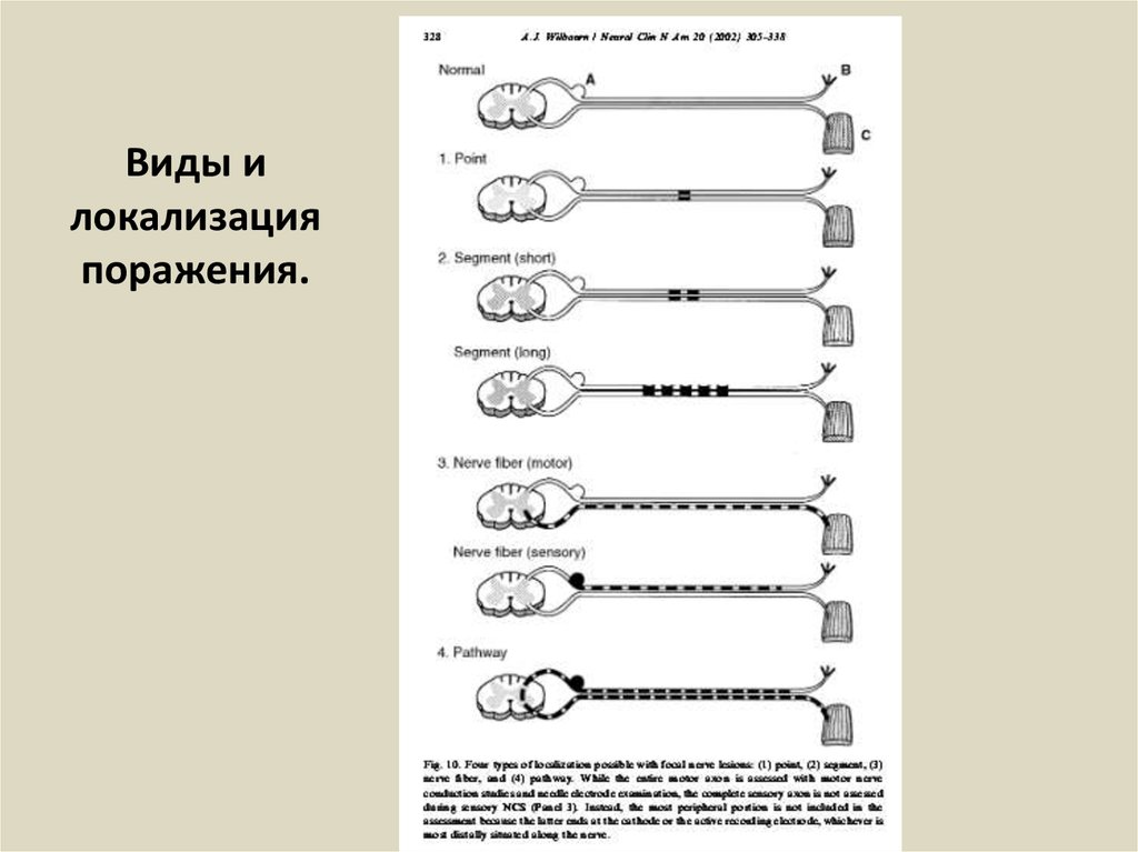 Виды и локализация поражения.