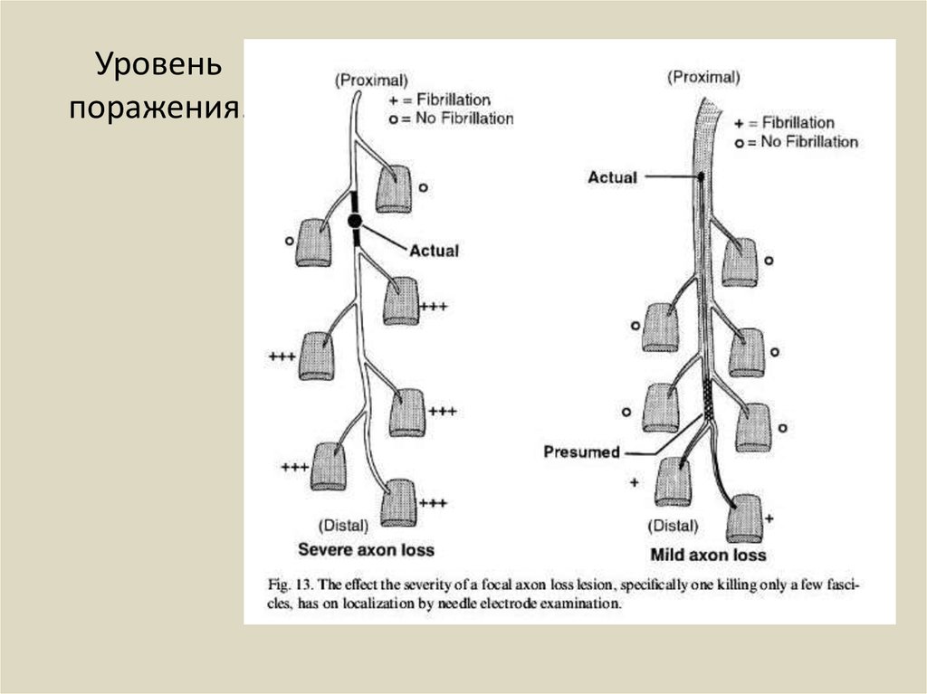 Уровень поражения