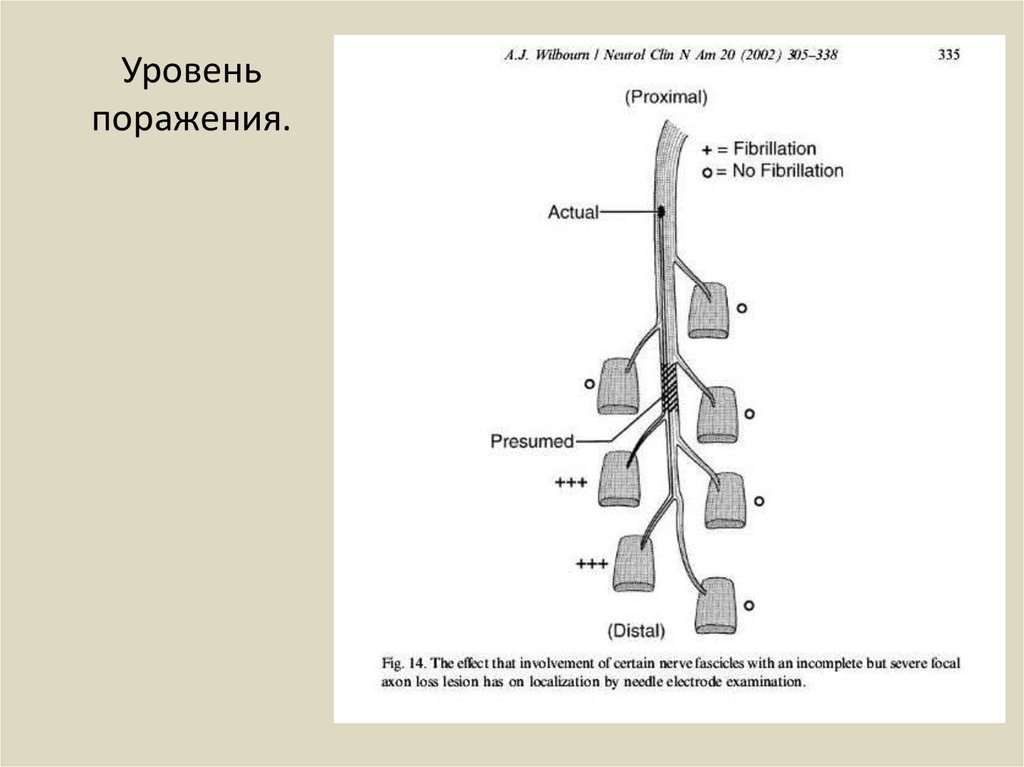 Уровень поражения