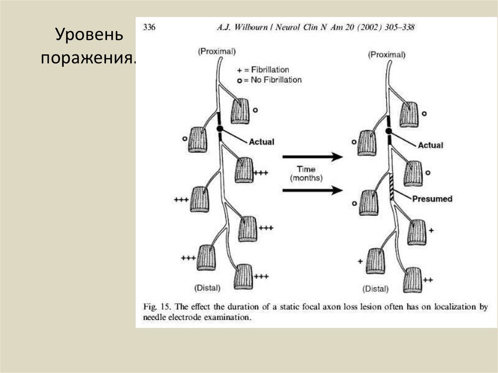 Уровень поражения