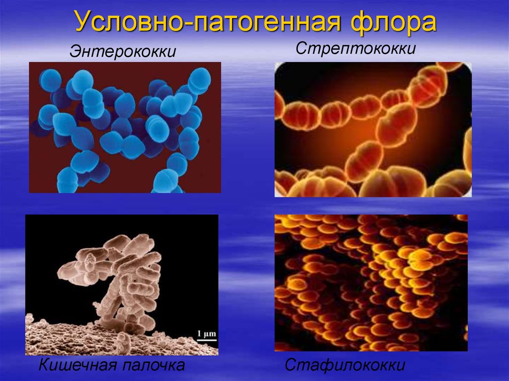 Условно патогенная микрофлора это. Условно-патогенные микроорганизмы. Патогенные и условно патогенные микроорганизмы. Условно патогенные микробы. Условно патогенные микроорганизмы человека.