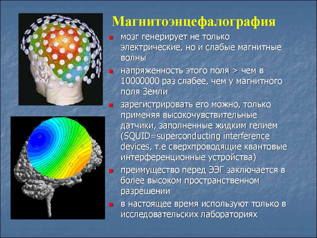 Мозг магнитное поле. Магнитоэнцефалография. Магнитоэнцефалография мозга. Магнитоэнцефалография сущность метода. Электромагнитное поле мозга.