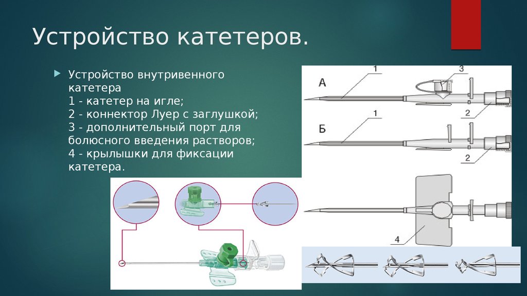 Виды катетеров схема