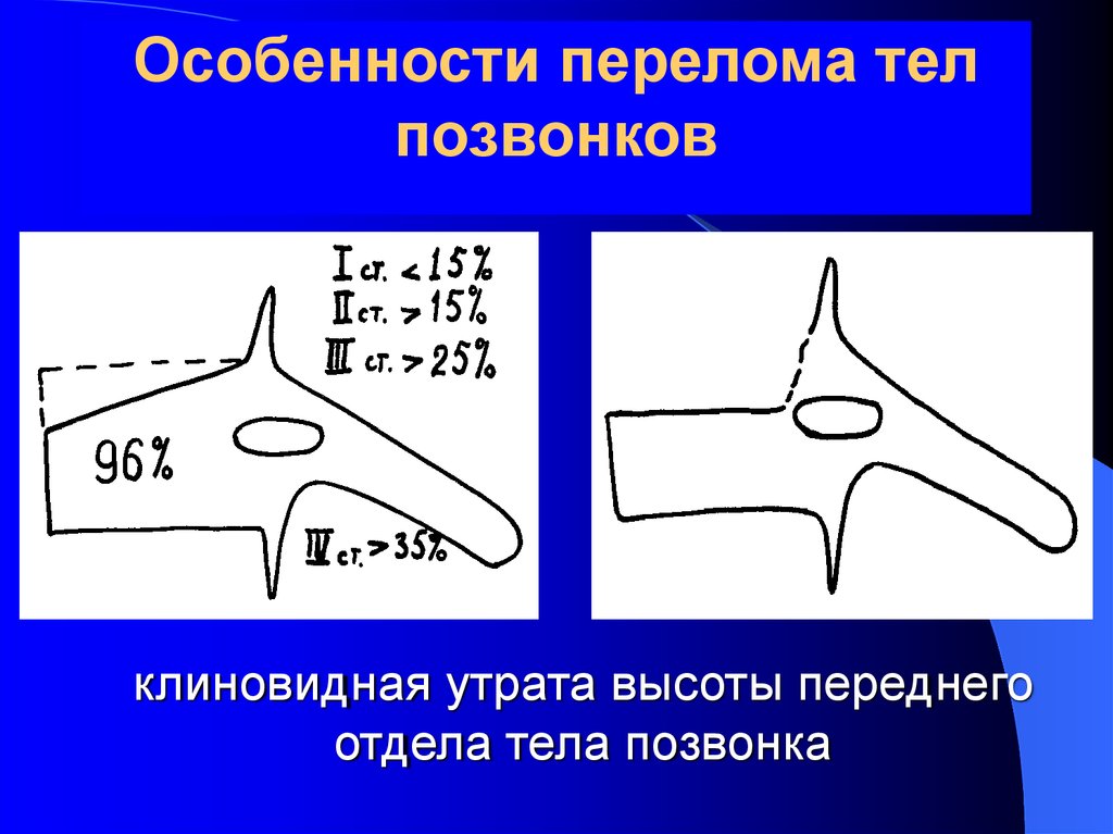 Клиновидные позвонки. Клиновидный перелом тел позвонков. Переломы тел позвонков могут быть. Индекс клиновидности позвонков. Передняя клиновидность позвонков.