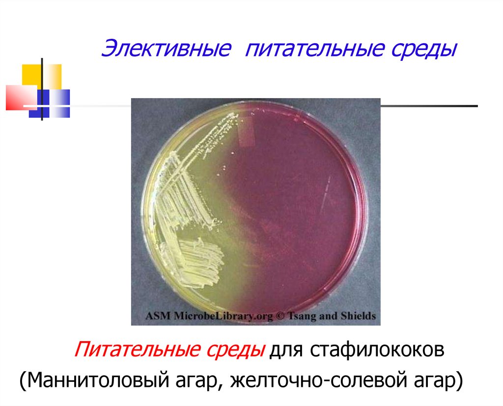 Питательная среда это. Элективные и селективные питательные среды. Элективные среды микробиология. Микробиологические питательные среды состав. Элективные питательные среды питательные среды.