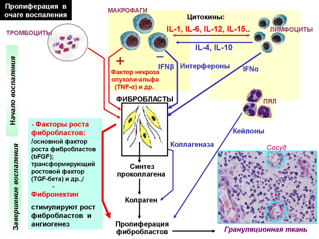 Макрофаги 4. Схема патогенеза хронического воспаления. Пролиферация клеток эпителия. Механизм развития пролиферативного воспаления. Пролиферация клеток схема.
