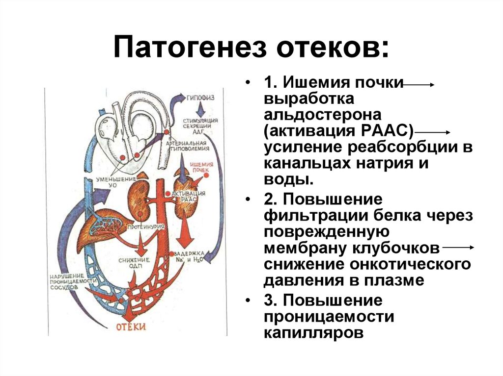 Отек почек