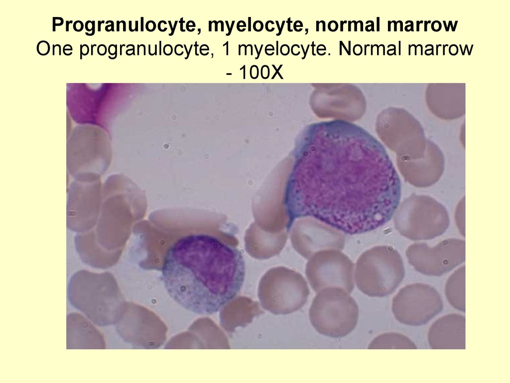 Миелоцит фото под микроскопом