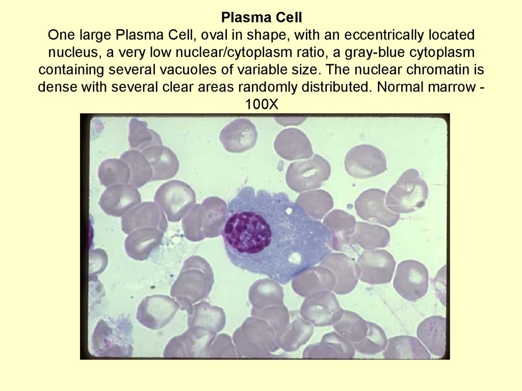 Кристалл костный мозг. Эритробласт морфология. Плазма клетки.