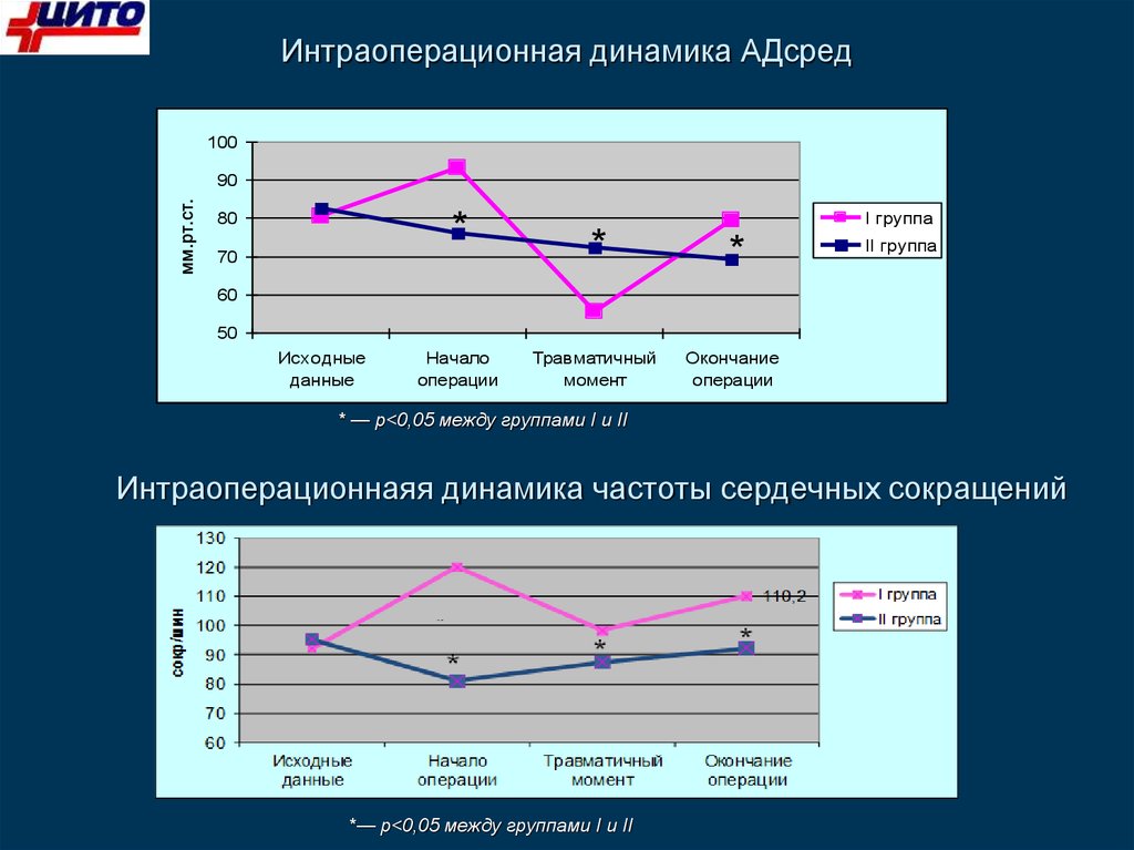 Частоты динамиков