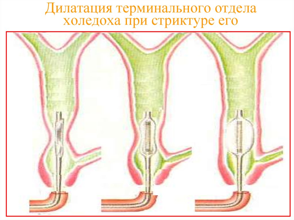 Дилатация изображения это