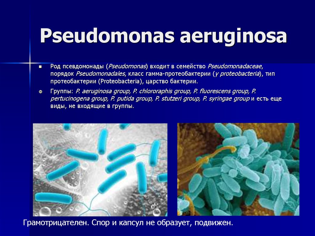 Микробиологические на аэробные микроорганизмы. Бактерии псевдомонады. Псевдомонады синегнойная палочка микробиология. Синегнойная палочка (p.aeruginosa). Синегнойная палочка аэроб.