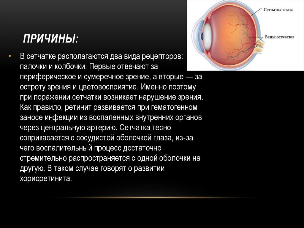 Отслойка сетчатки причины. Периферическая лазеркоагуляция сетчатки глаза. Сетчатка глаза сетчатка. Заболевания сетчатой оболочки глаза. Сетчатая оболочка глаза.