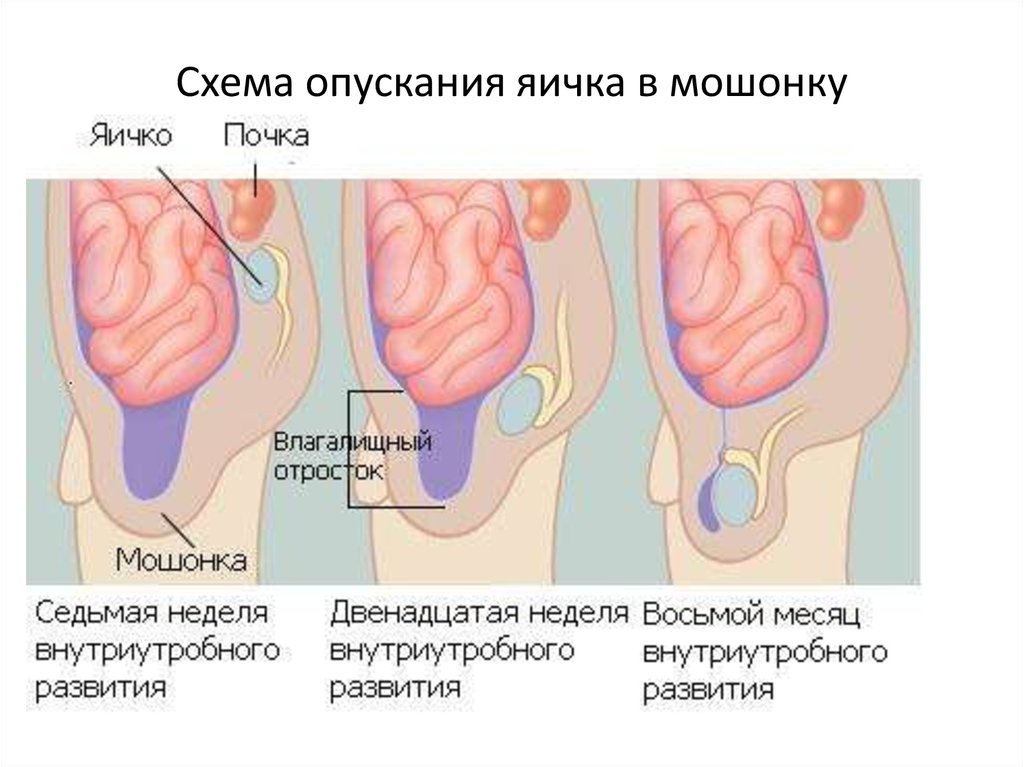 Схема опускания яичка