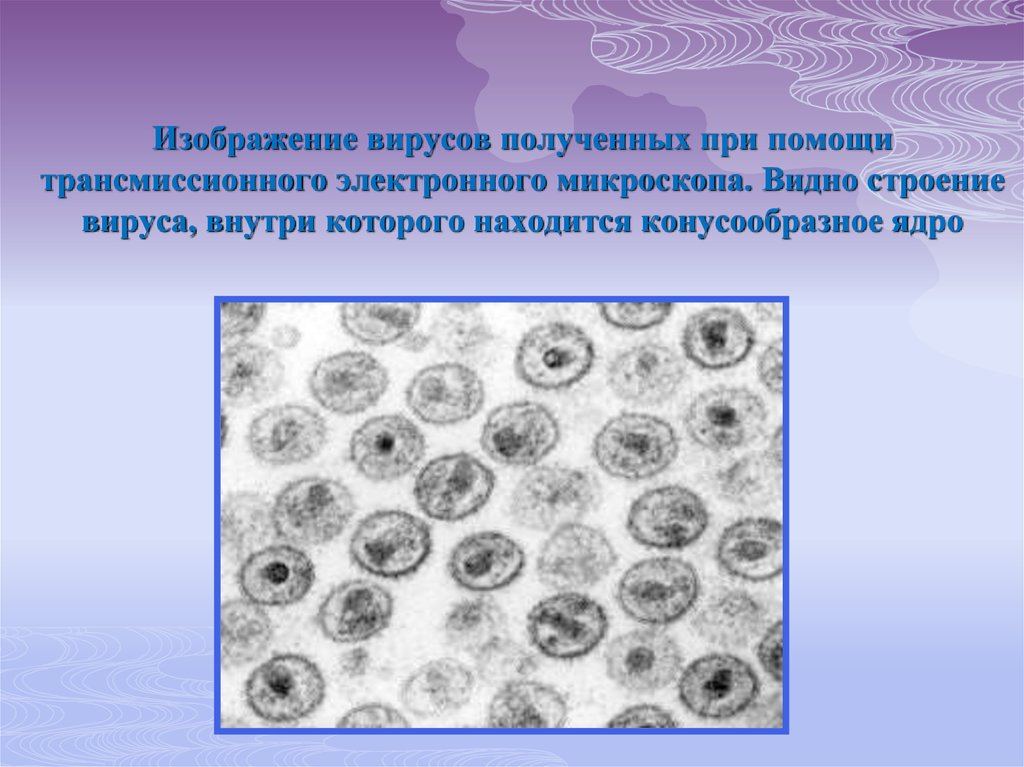 Изображение вирусов полученных при помощи трансмиссионного электронного микроскопа. Видно строение вируса, внутри которого находится ко