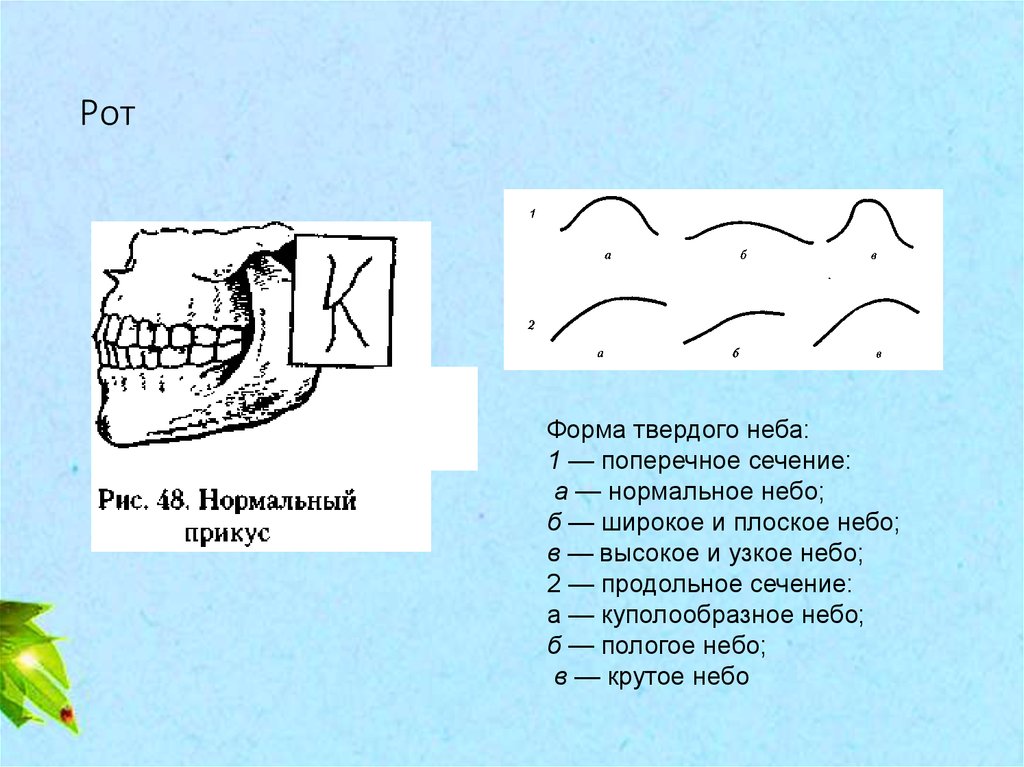 Правильный прикус у человека схема сбоку