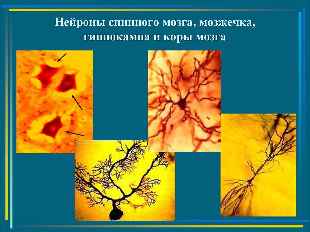 Нейроны спинного мозга характеристика. Нейроны спинного мозга. Классификация нейронов спинного мозга. Спинальные Нейроны физиология. Нейроны спинного мозга физиология.