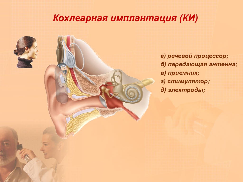 Нарушение среднего уха. Адгезивная болезнь среднего уха. Заболевания среднего и внутреннего уха. Адгезивная болезнь среднего уха справа.. Заболевания среднего уха презентация.