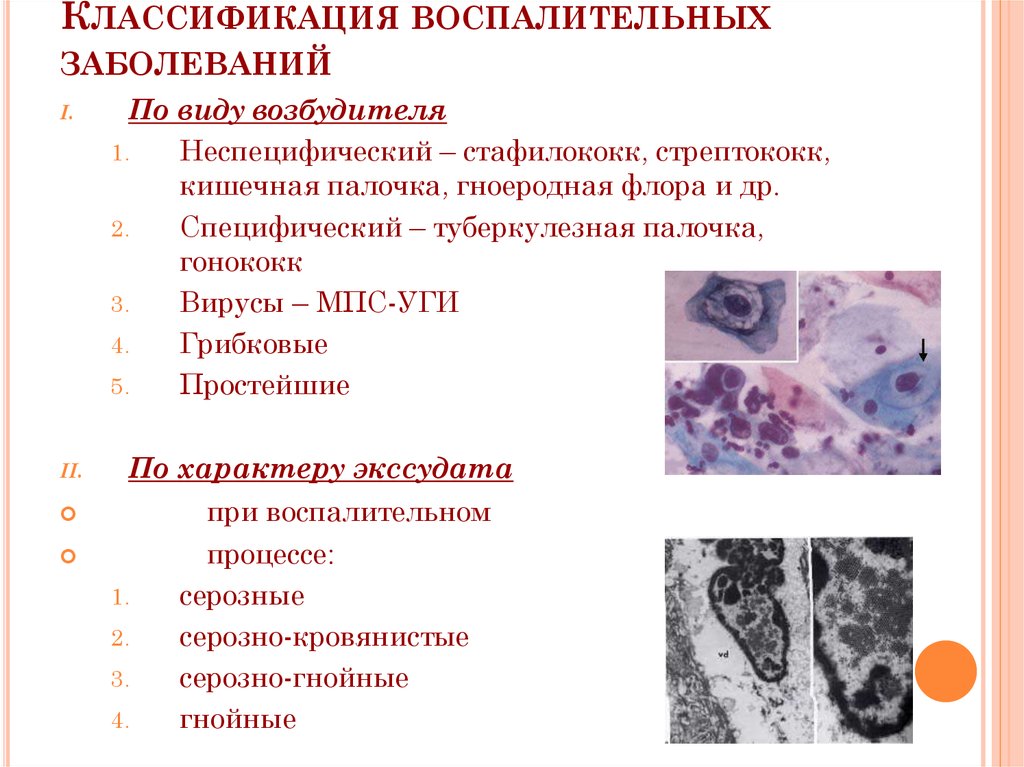 Цитологическая картина неспецифического воспаления