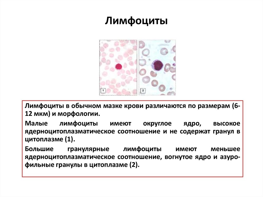 Как обозначаются лимфоциты в крови. Т-лимфоцит мазок крови. Лимфоциты средние и малые отличия. Содержимое гранул лимфоцитов. Характеристики лимфоцитов содержат гранулы ?.