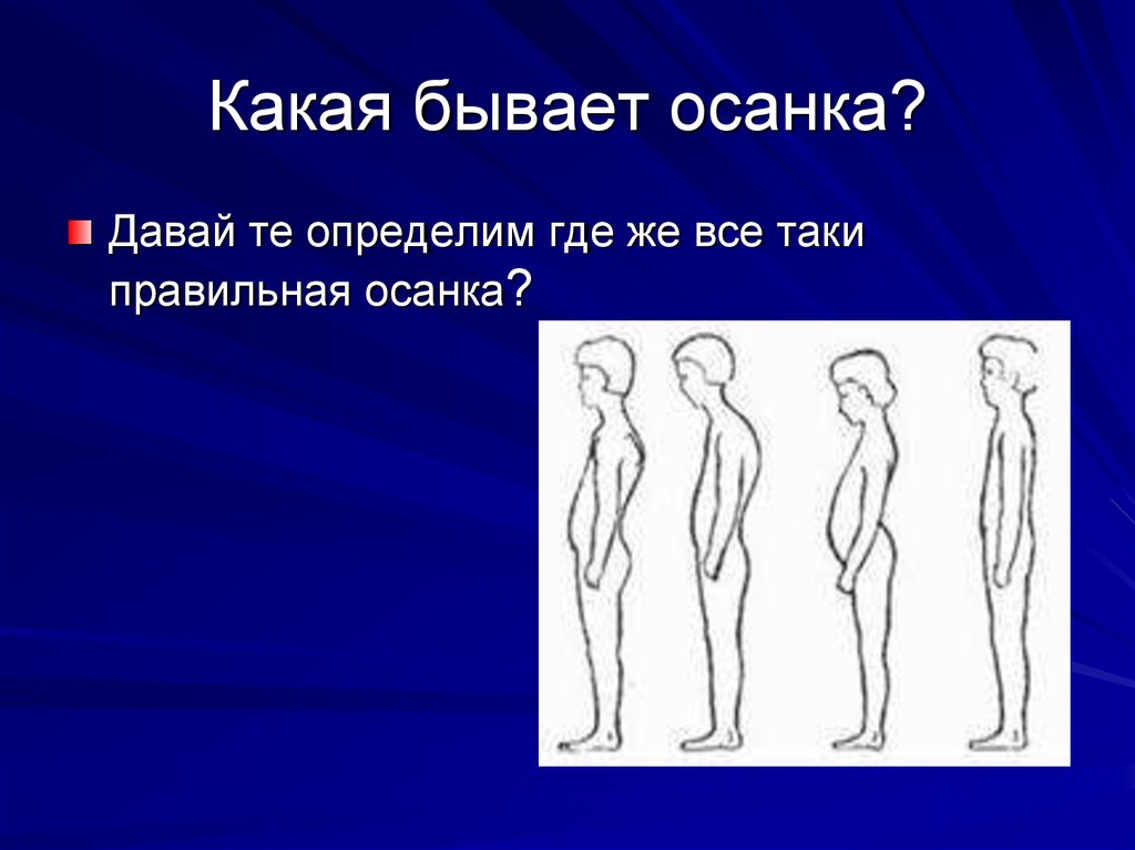 Какая осанка правильная. Виды осанки человека. Осанки человека причины. Как определить Тип осанки.