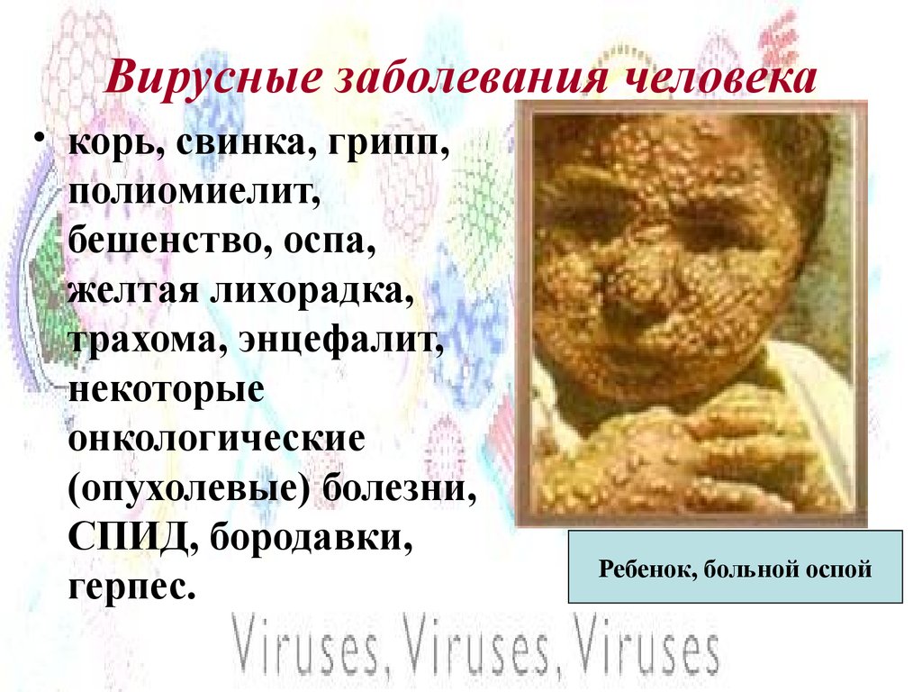 Вирусные заболевания человека