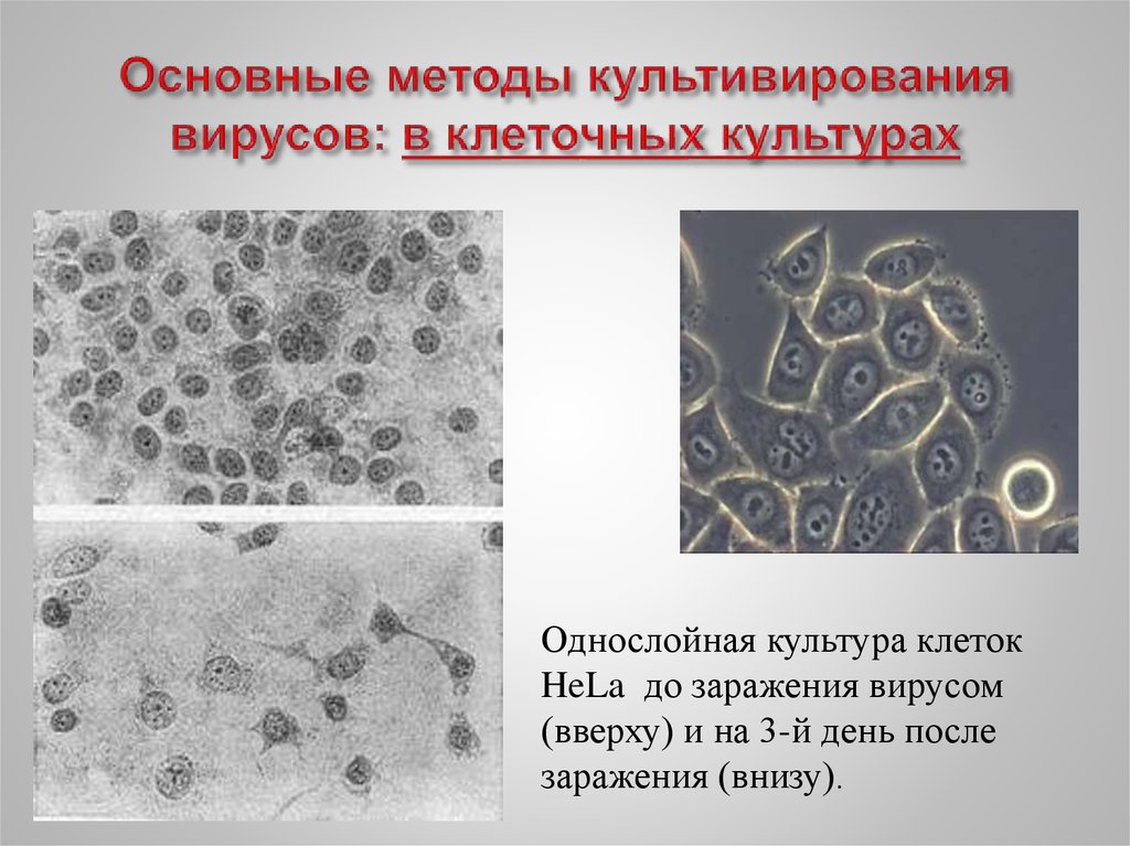 Культура клеток. Метод культуры клеток вирусы. Культивирование вирусов в культуре клеток. Методы культивирования вирусов в клеточных культурах. Методы выявления вирусов в культурах клеток.