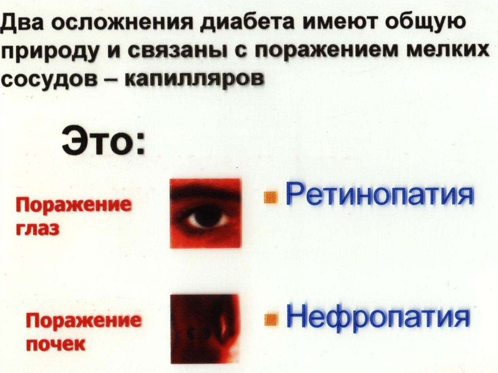 Последствия диабета. Поздние осложнения сахарного диабета презентация. Страшные последствия диабета. Последствия диабета картинки. Осложнения после диабета.