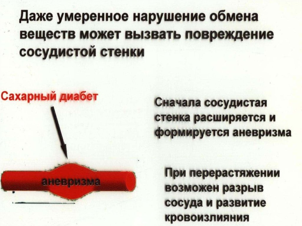 Умеренное нарушение. Повреждение сосудов при сахарном диабете патогенез. Аневризма при сахарном диабете. Сахарный диабет механизм ключи.