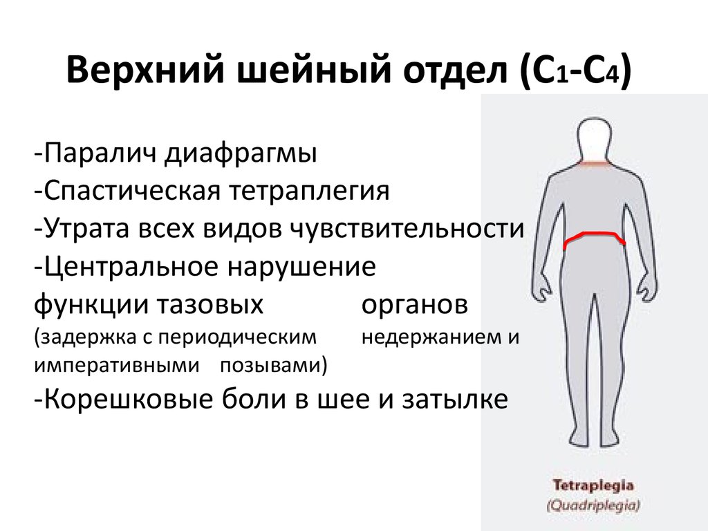 Полное поражение. Шейный корешковый синдром. Синдром поражения шейного отдела спинного мозга. Корешковые синдромы грудного отдела отдела.