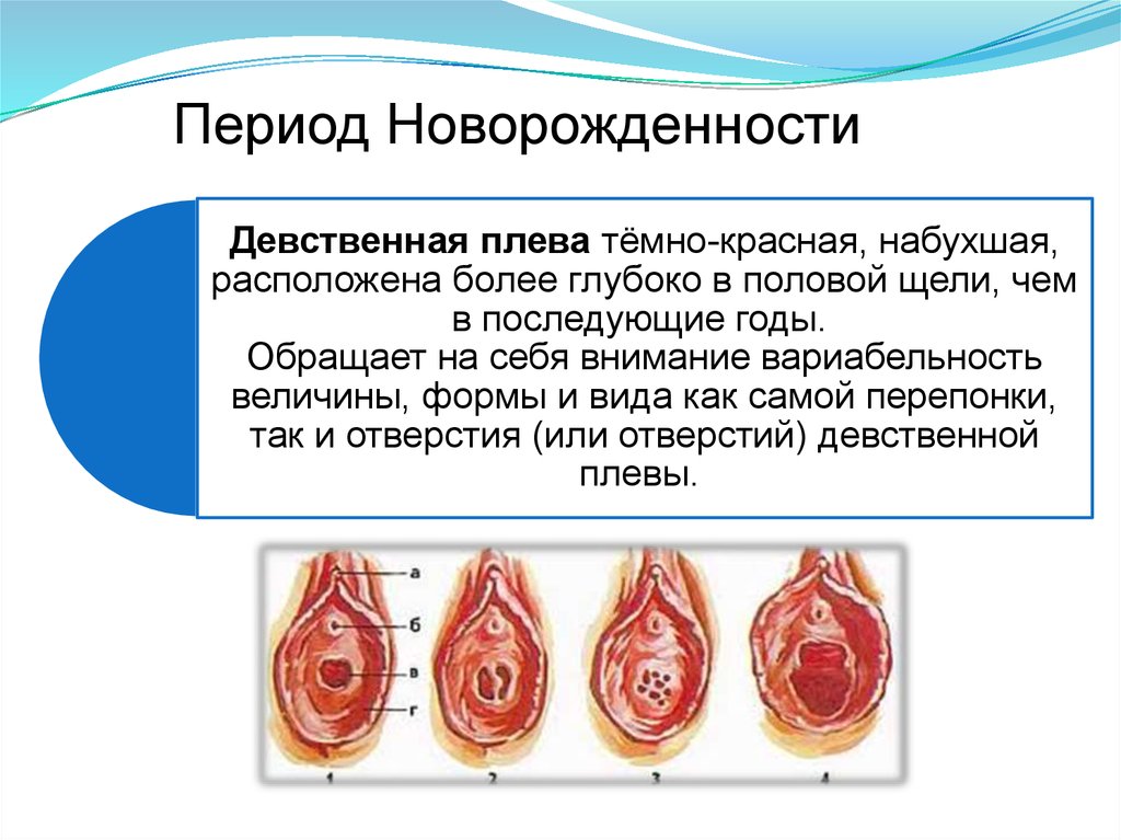 Особенности строения девственной плевы