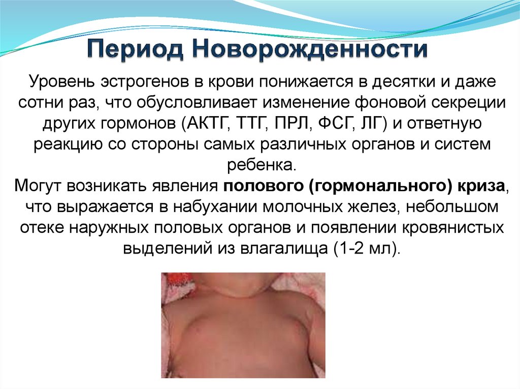 Период Новорожденности