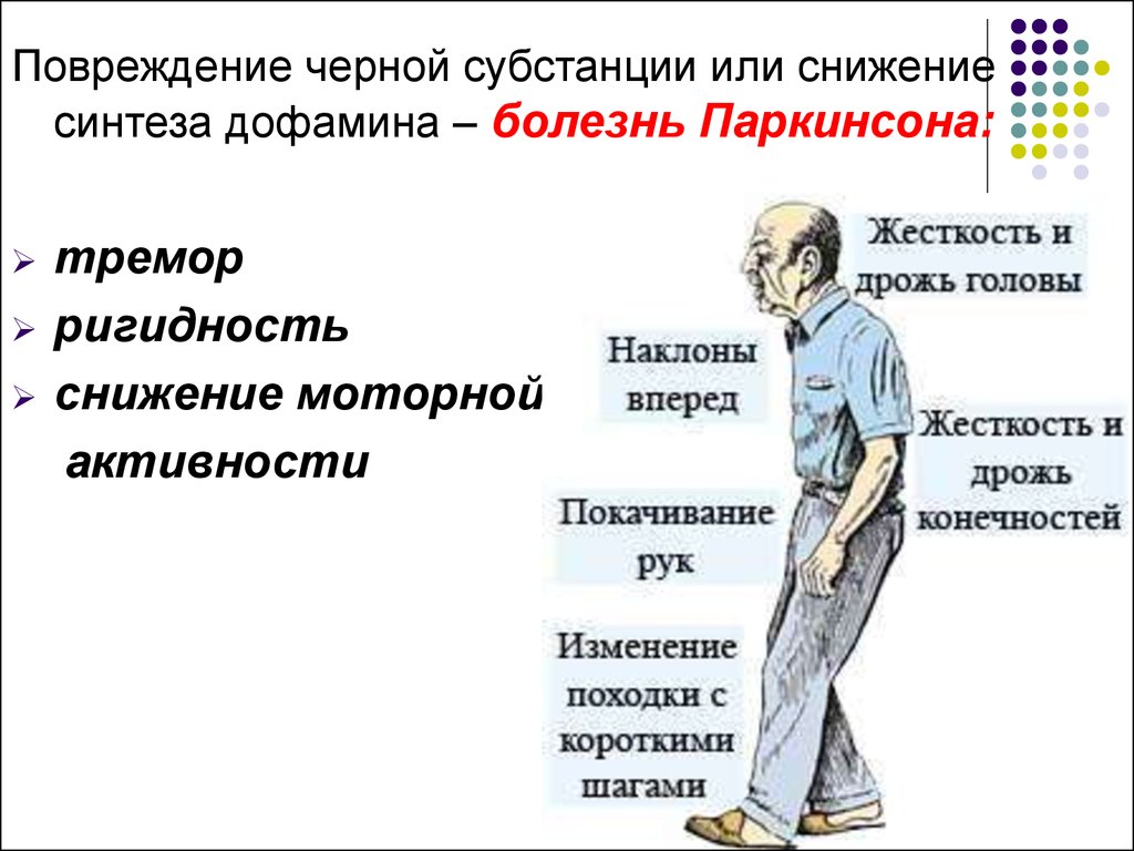 Болезнь паркинсона презентация по неврологии