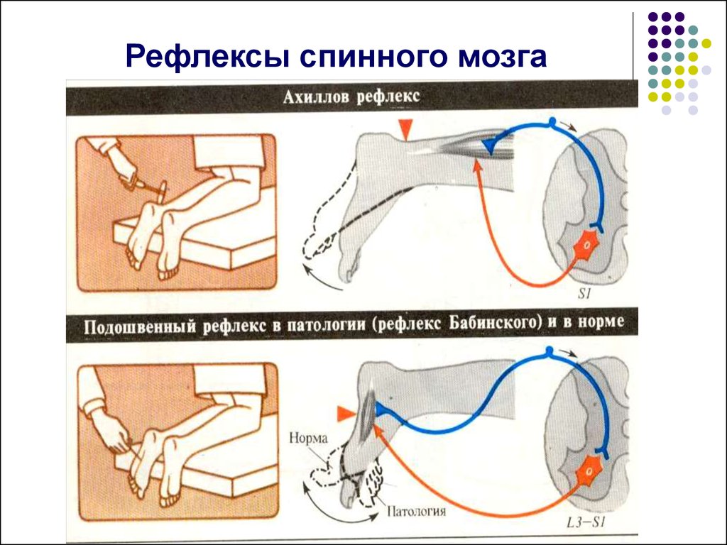 Схема ахиллова рефлекса