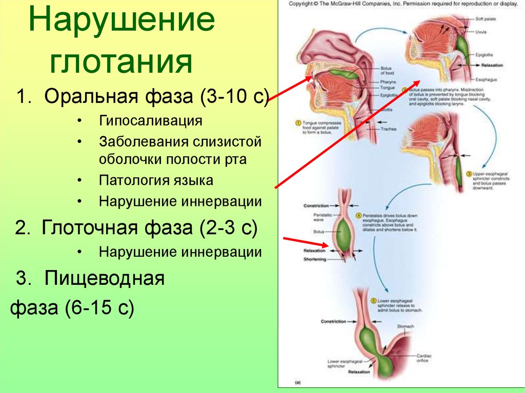 Схема глотательного рефлекса