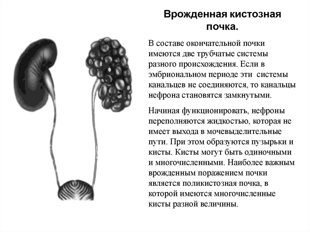 Почки по составу. Окончательная почка. Кистозная трансформация почки. Трубчатая система почек. Происхождение мочевыделительной системы.