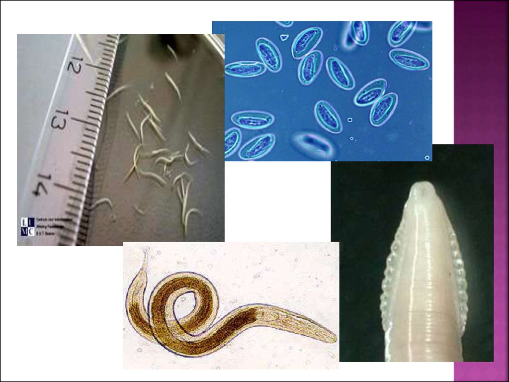 Виды глистов. Черви паразиты гельминты. Гельминтозы энтеробиоз. Гельминтология (гельминты, паразиты. Паразитические черви острицы.