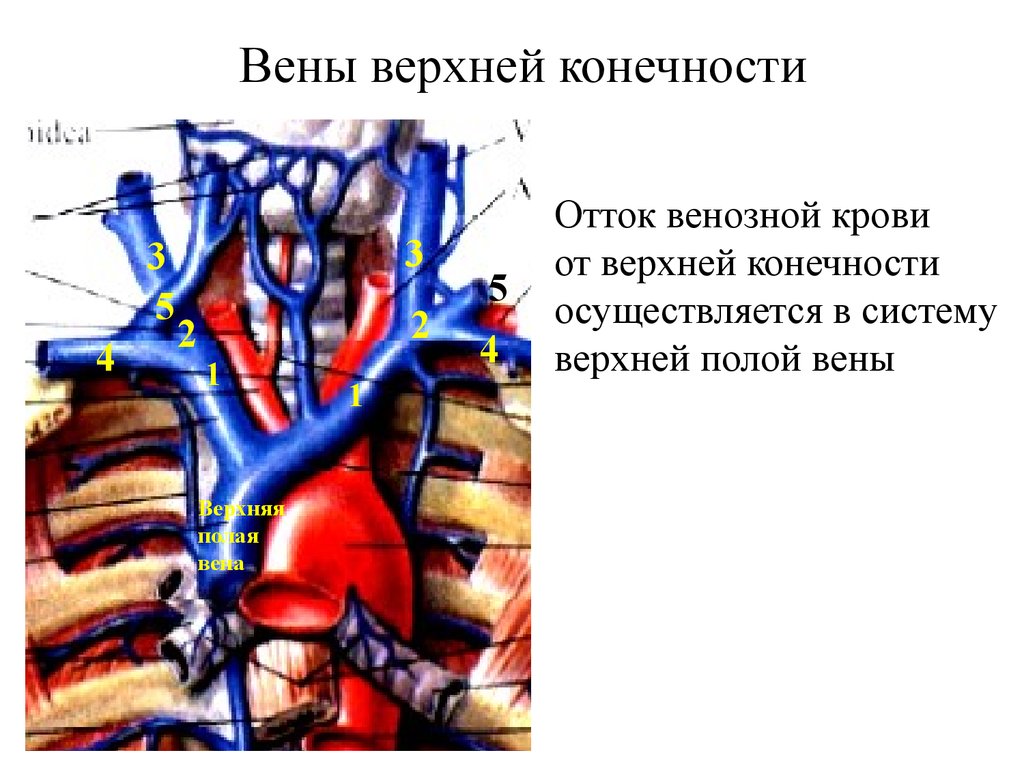 Две нижних полых вены. Внутренняя яремная Вена,наружная яремная Вена,подключичная Вена. Подключичная Вена анатомия схема. Верхняя полая Вена плечеголовные вены. Плечеголовная Вена анатомия.