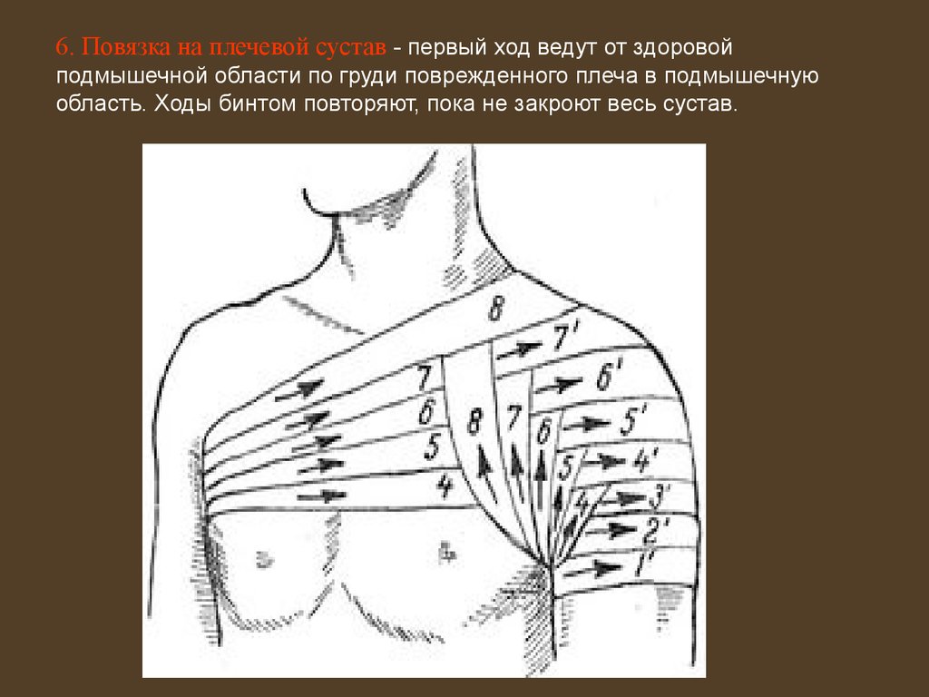Колосовидная на плечо. Бинтовая повязка на плечевой сустав. Колосовидная повязка на подмышечную область. Повязка на подмышечную впадину. Перевязка подмышечной впадины.