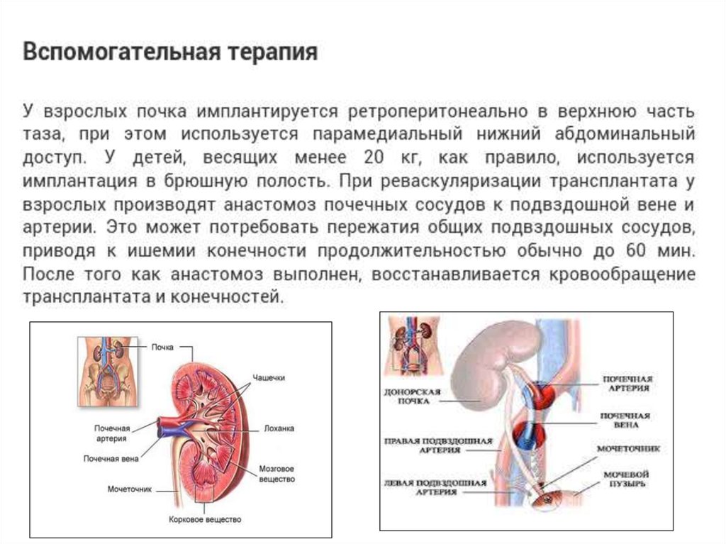 Почки взрослого. Трансплантация сосудов почки. Компенсация функций путем трансплантации почки. Трансплантация почки презентация. Трансплантация почки меры профилактики.