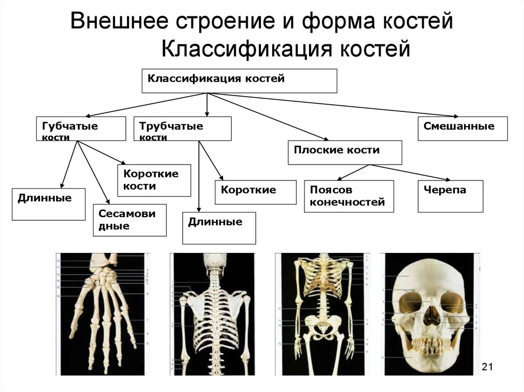 Основным признаком изменений костей является