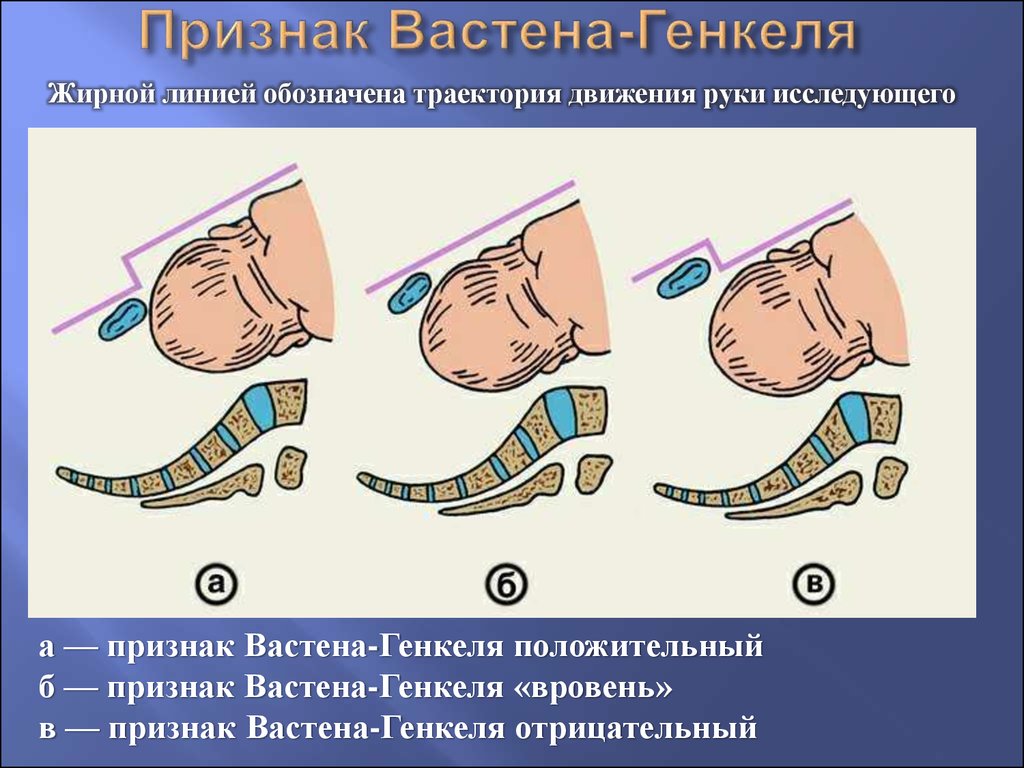 Плоские соски у женщин фото