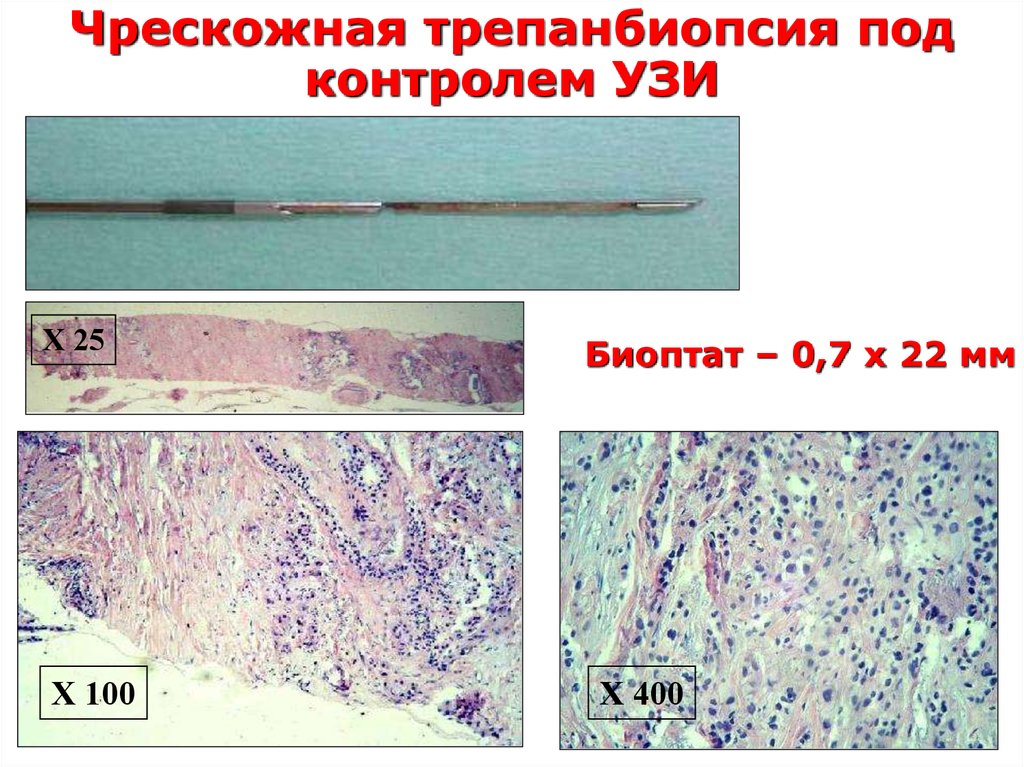 Онкология хирургия презентация