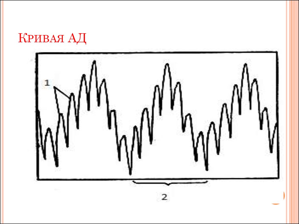 Анализ кривых. Кривая артериального давления физиология. Кривая артериального давления в остром опыте. Кривая ад в остром опыте. Анализ Кривой ад.