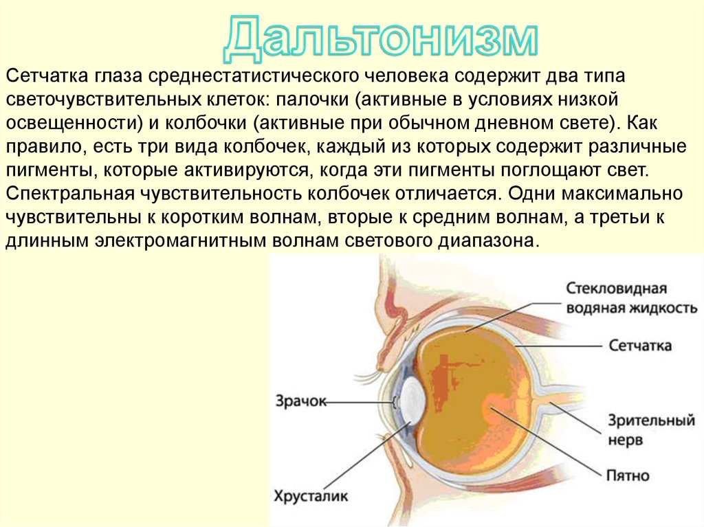Жидкость в сетчатке. Дальтонизм строение глаза. Строение глаза при дальтонизме. Дальтонизм сетчатка. Светочувствительные клетки глаза.