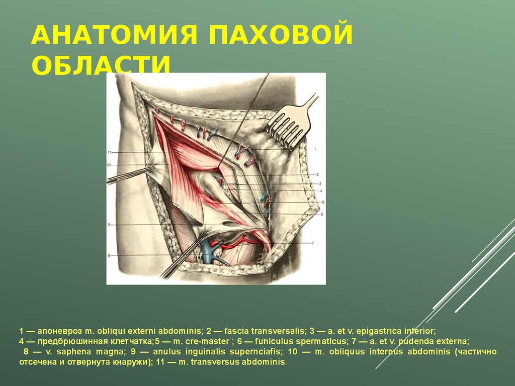 Паховая складка у мужчин где находится картинка