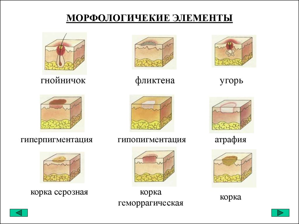 Этиология сыпей